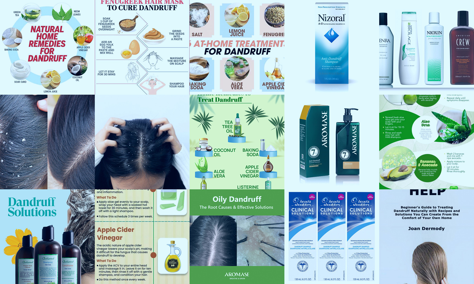 solutions for dandruff