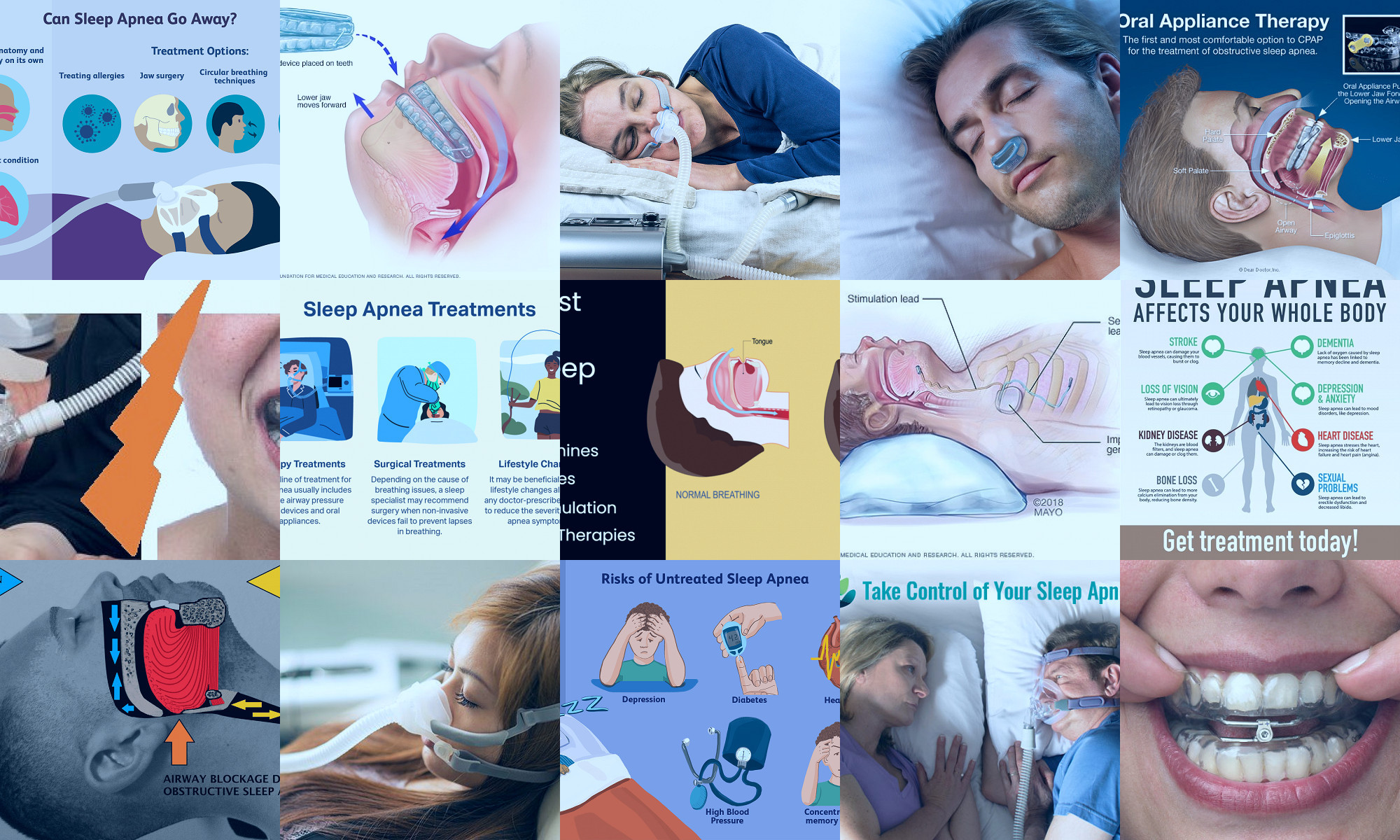 solutions for sleep apnea